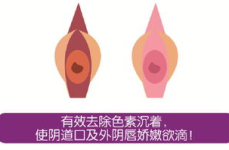私密收紧有效果没,揭秘塑形秘诀
